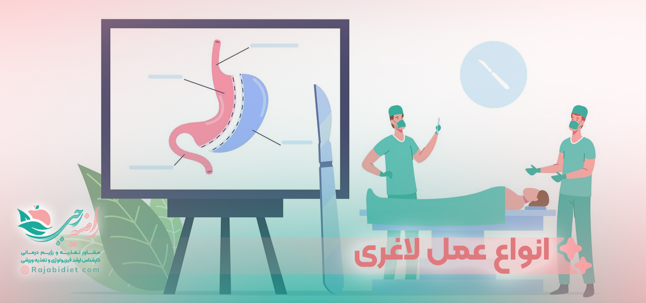 انواع عمل لاغری