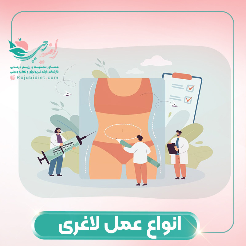 انواع عمل لاغری چیست؟
