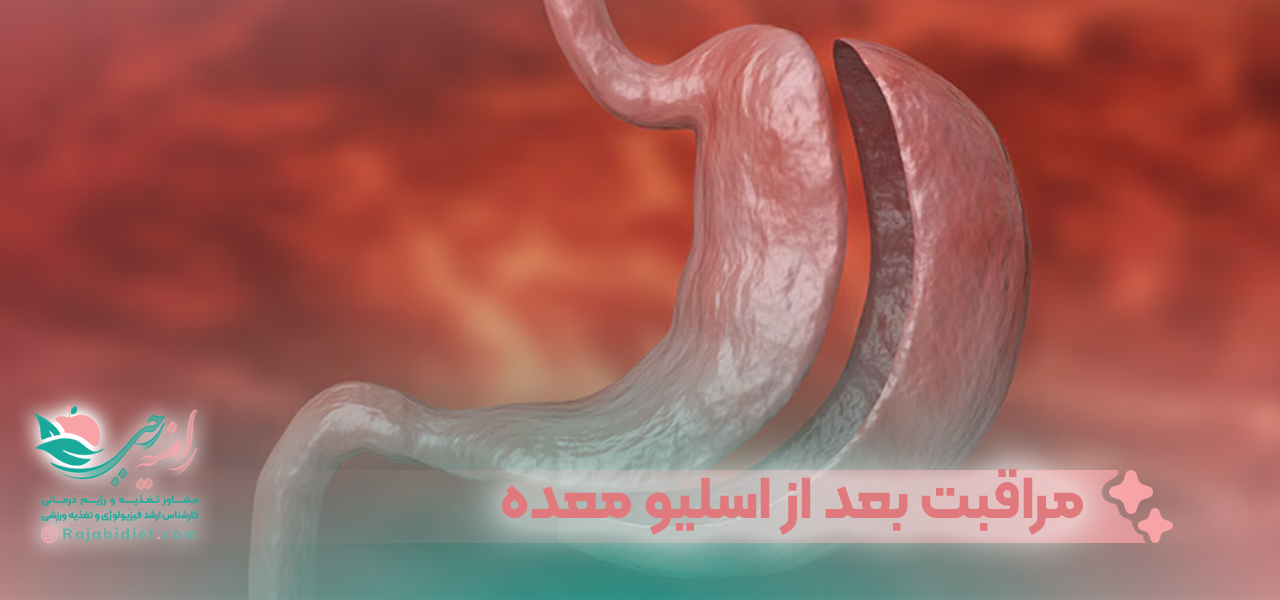 مراقبت های بعد از انجام اسلیو معده