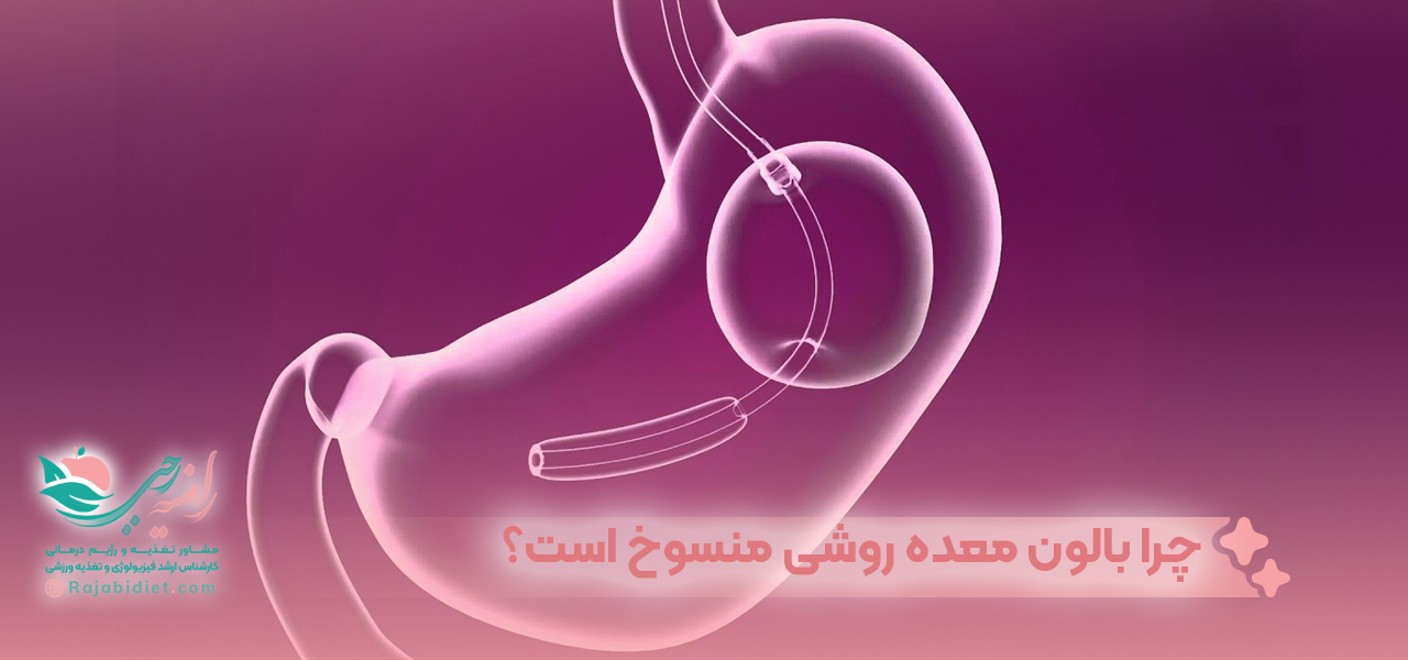 چرا بالون معده روشی منسوخ است؟