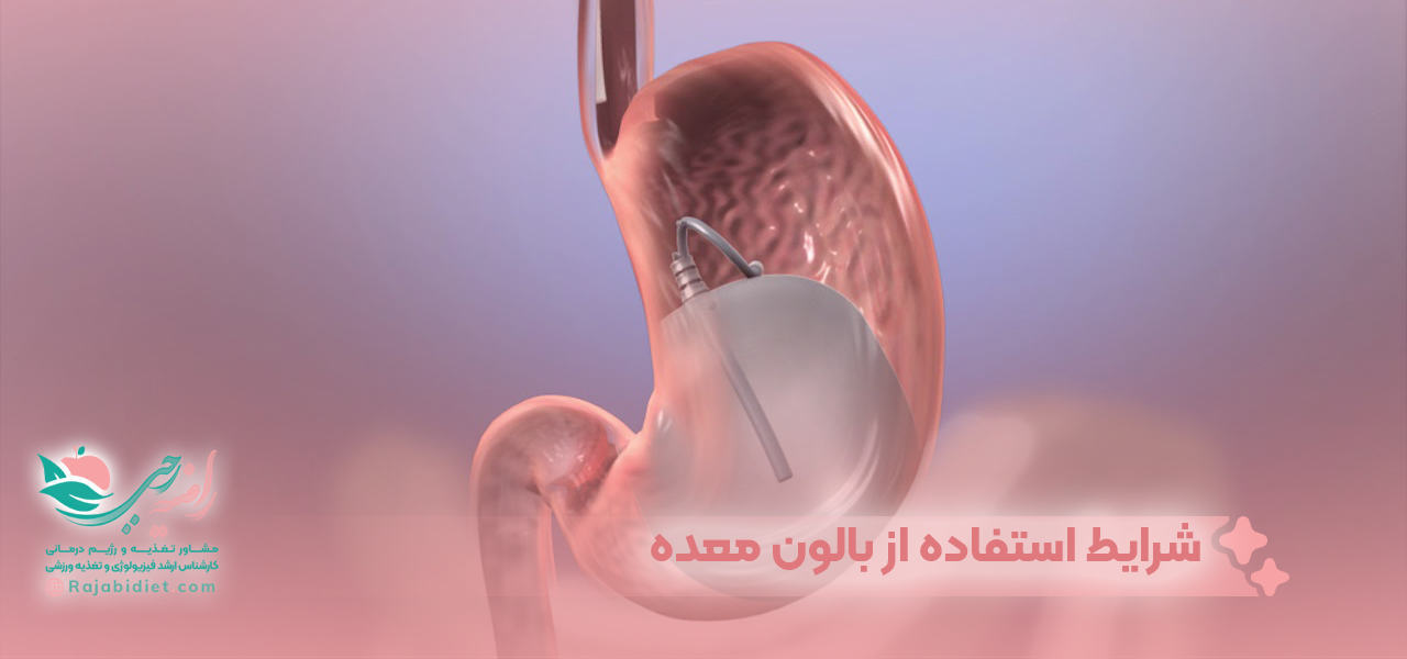 شرایط استفاده از بالون معده