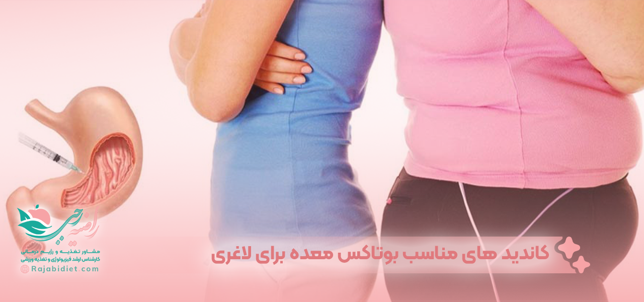 کاندید های مناسب بوتاکس معده برای لاغری