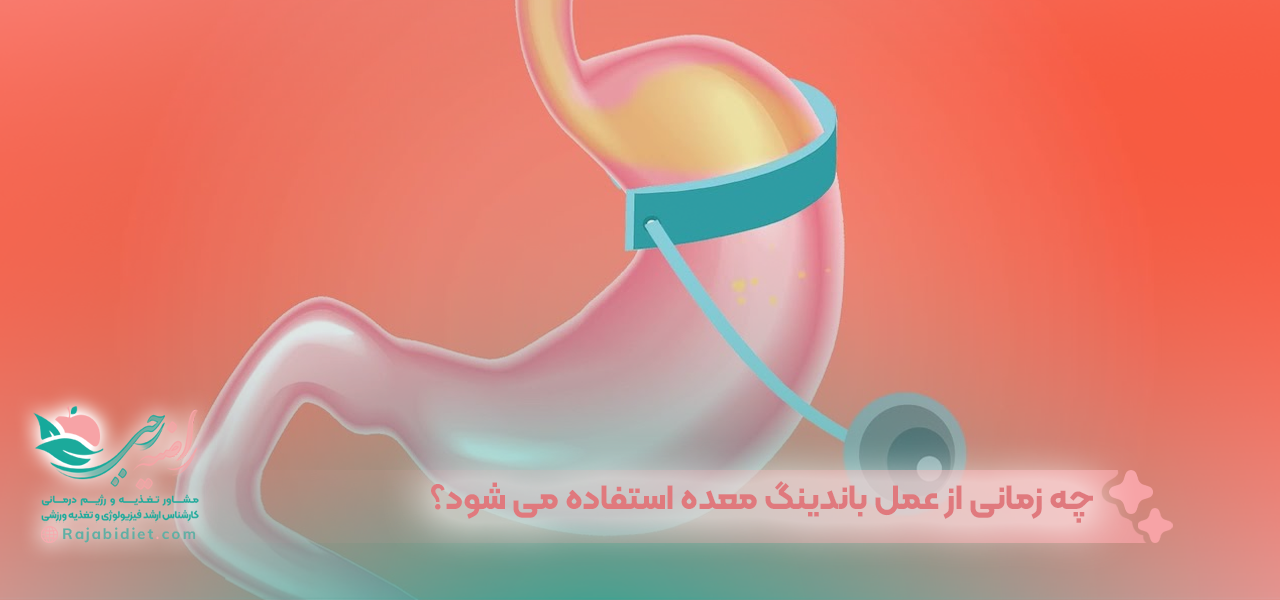 چه زمانی از عمل باندینگ معده استفاده می شود؟