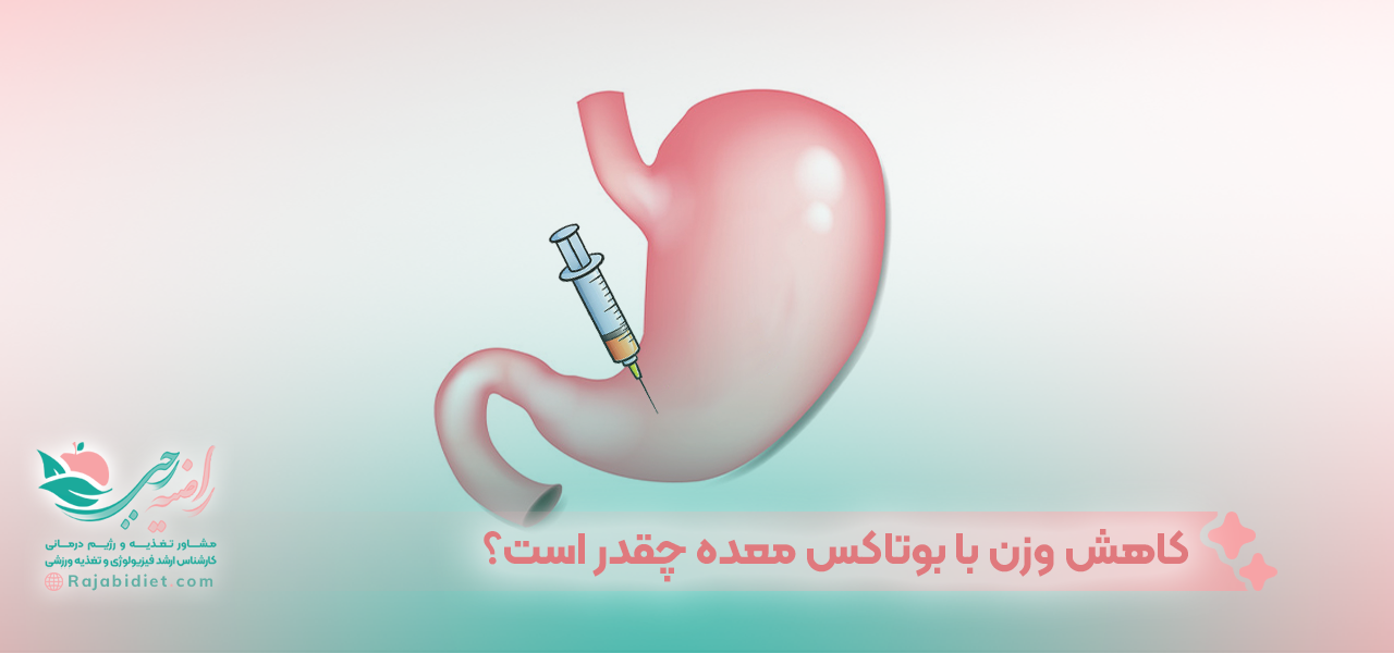 کاهش وزن با بوتاکس معده چقدر است؟